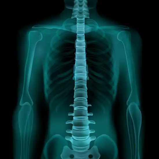 whole body bone scan